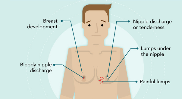 how-to-get-rid-of-puffy-nipples